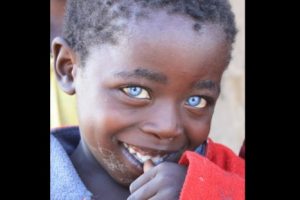 FOTOS: Conoce al niño africano de los ojos de zafiro