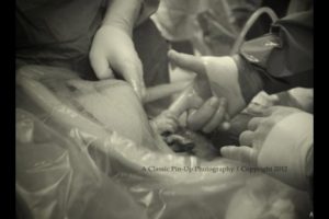 Fotografían a bebe agarrando dedo de médico antes de salir de vientre