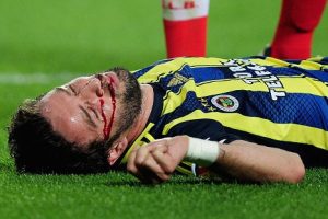 Defensa termina inconsciente tras terrible patada en semifinales de la Europa League – VIDEO