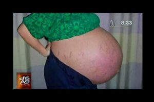 Mujer iraquí está embarazada de trece bebés – VIDEO