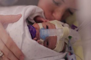 Conmovedor video muestra la lucha de un bebé con la muerte
