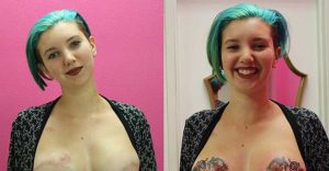 Mujer se tatuó los pechos luego de su mastectomía, ¡este fue el resultado!