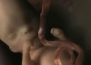 El ‘milagro’ de la vida: Así es como se alimentan los bebés en el vientre materno (VIDEO)