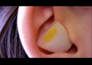 Salud: Esto pasa cuando pones una cebolla en tu oreja