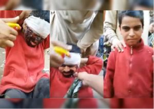 YouTube: Niño se disfrazaba de persona quemada para pedir limosna