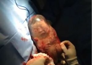 Facebook: Bebé nace dentro de su bolsa y se mueve sin saber que ya ha nacido (VIDEO)
