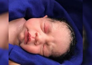 Nació el primer bebé del útero trasplantado de un cadáver