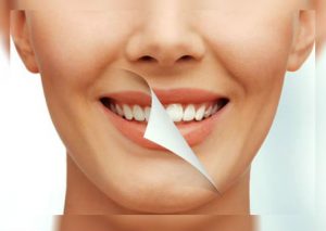 Cuatro formas de blanquear tus dientes de una manera natural