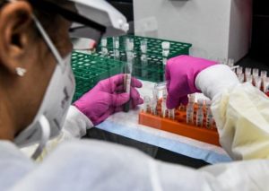 Dos laboratorios buscan peruanos voluntarios para probar la vacuna