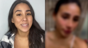 Samahara Lobatón luce IRRECONOCIBLE tras RADICAL CAMBIO en su ROSTRO | VIDEO