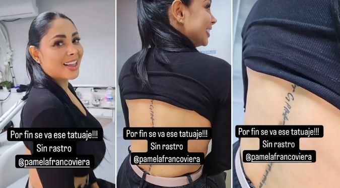 Pamela Franco se borra tatuaje dedicado a Christian Domínguez: “Sin rastro” 