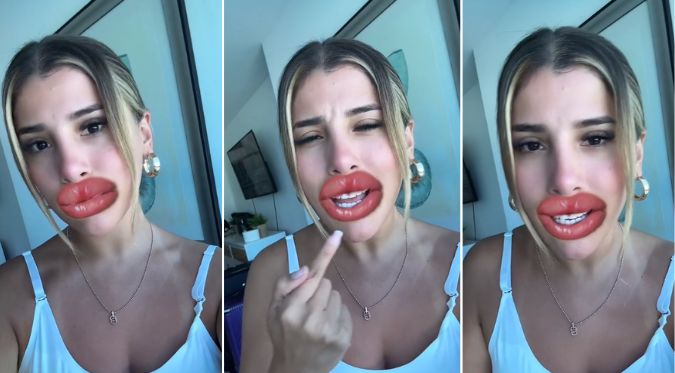 Yahaira Plasencia se burla de las críticas de su retoque de labios y sus fans la apoyan [VIDEO]